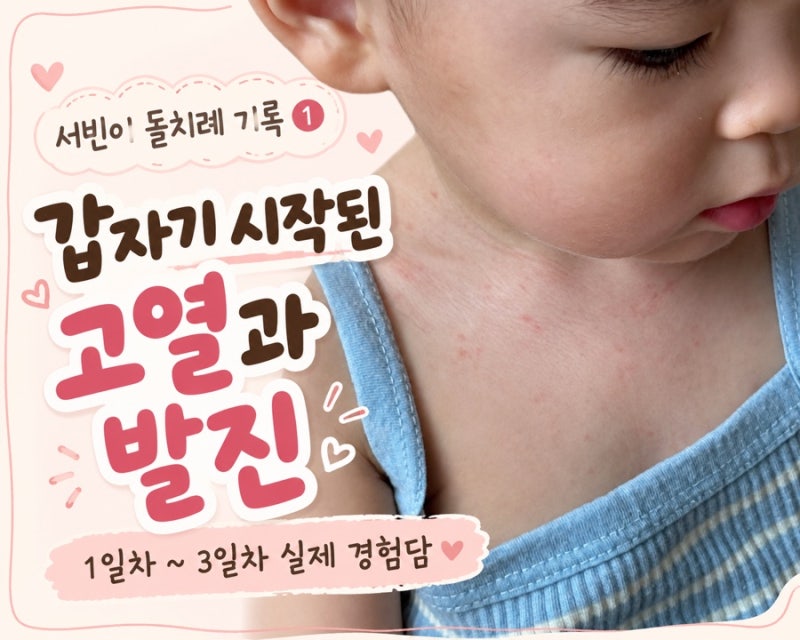 아기 돌치레 증상과 열｜돌발진 1일차~3일차 실제 경험담, 해열제 대처방법