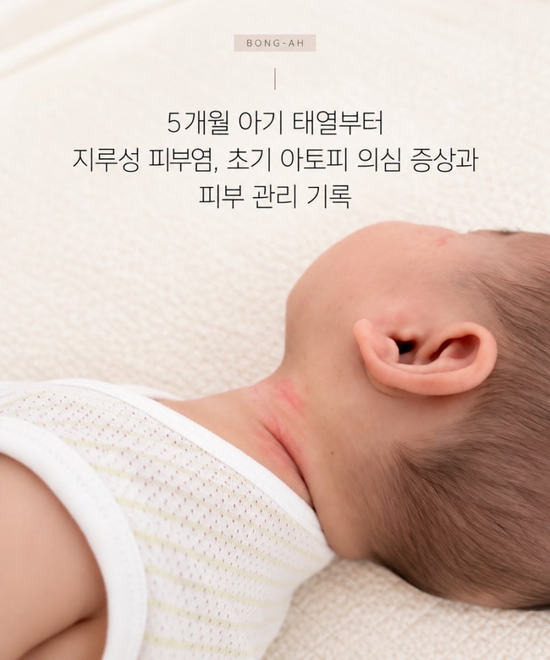 5개월 아기 태열부터 지루성 피부염, 초기 아토피 의심 증상과 피부 관리 기록
