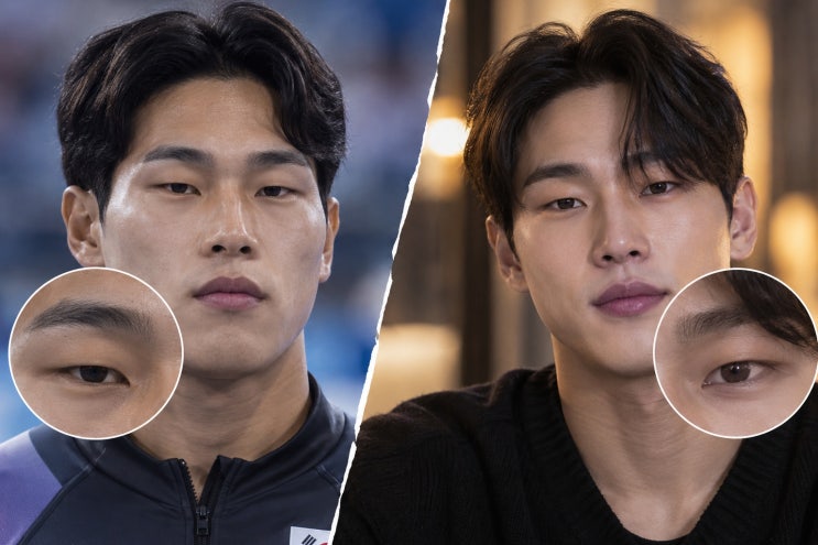 윤성빈 <b>쌍꺼풀 수술</b> 의혹 총정리, 달라진 눈매의 이유는 보톡스?
