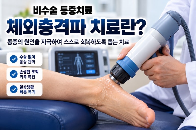 체외충격파 치료란? 치료방법·비용·보험·치료 후 관리까지