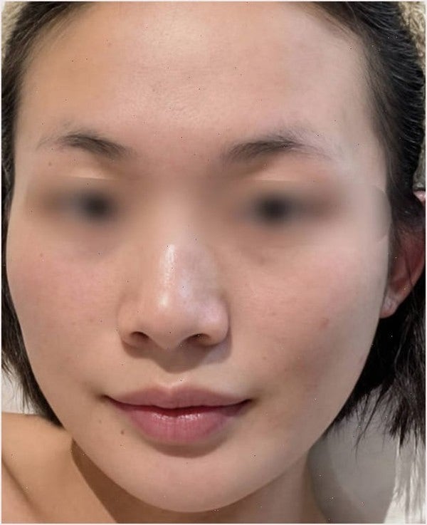 마데카솔 분말 궁금한 분들!