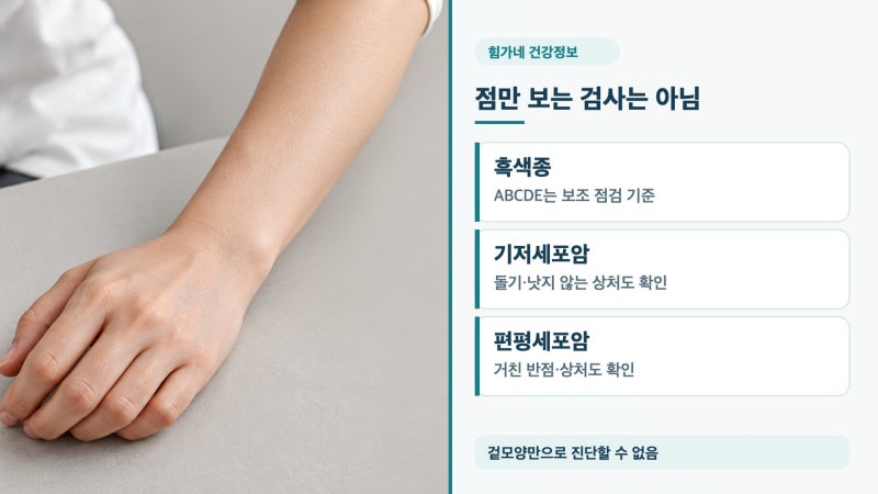 피부암점특징, 흑색종 ABCDE와 피부과 확인이 필요한 변화