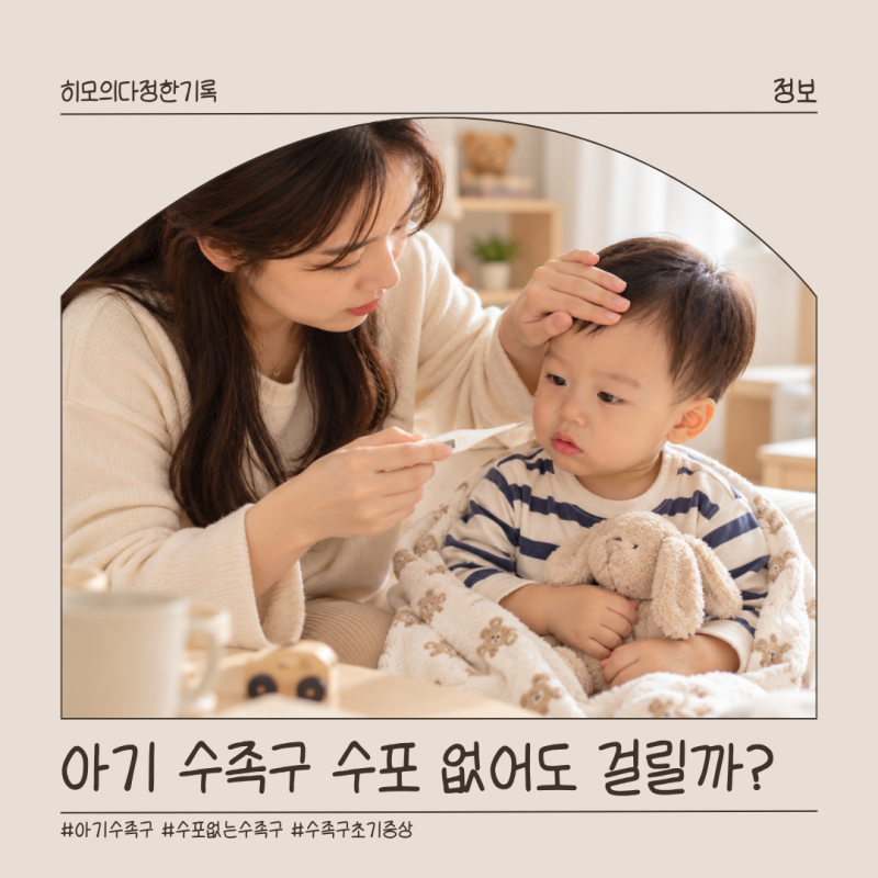 아기 수족구 수포 없을 수도? 초기증상 잠복기와 등원 시기