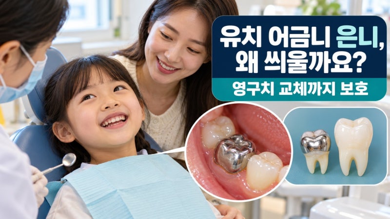 유치 어금니 충치 은니(SS크라운) 씌우는 이유와 영구치 교체 시 정상 탈락 과정