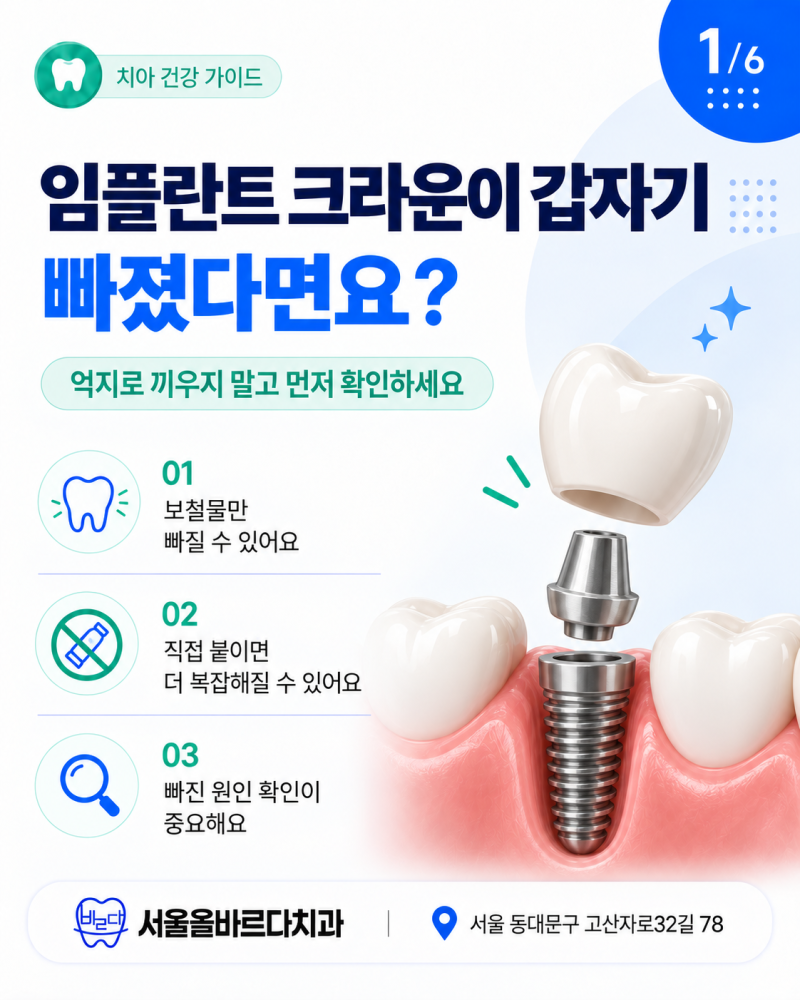 도봉구치과 임플란트 크라운이 갑자기 빠졌는데 다시 끼우면 될까요