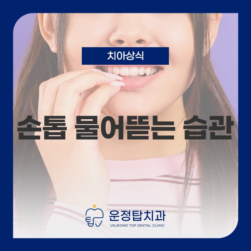 손톱물어뜯는습관, 구강 건강에 미치는 영향과 관리 방법