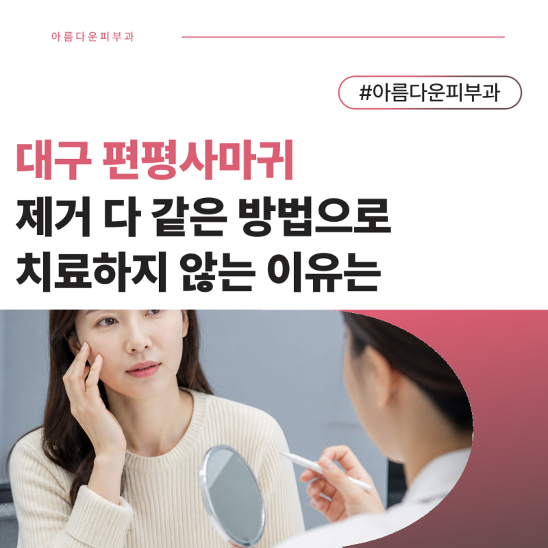 대구 편평사마귀 제거 다 같은 방법으로 치료하지 않는 이유는