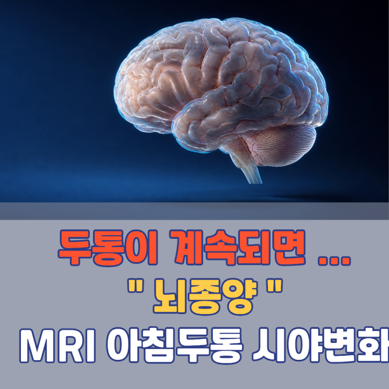 "이 통증이 아침마다 계속되면 암일 수도 있습니다!" 뇌종양 초기증상 | 아침두통 두통구토 ....