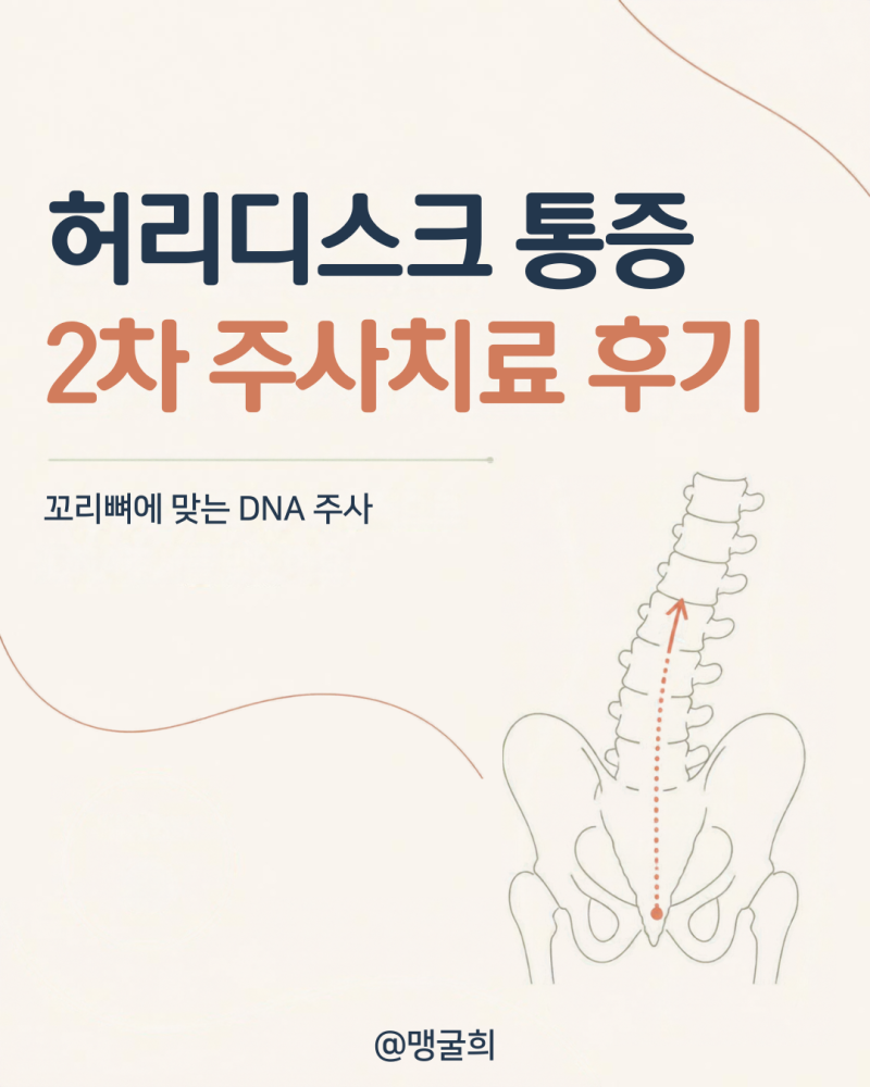 30대 허리디스크 2차 주사치료 후기 꼬리뼈에 DNA주사 맞은 후 통증
