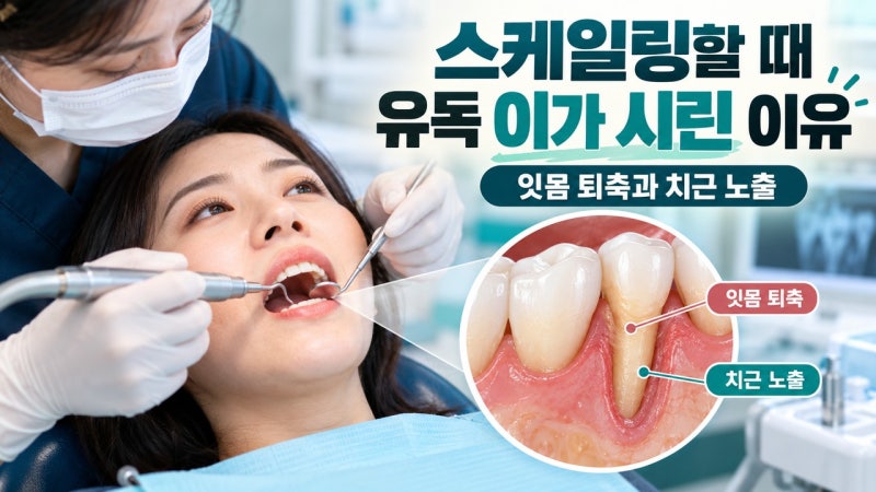 스케일링할 때 유독 이가 시리고 통증이 심한 사람의 잇몸 퇴축과 치근 노출 원인