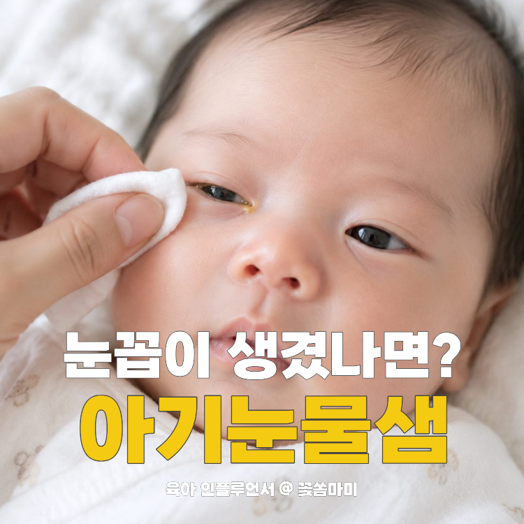 아기눈물샘 막히면 눈꼽이 생길까? 신생아눈꼽 원인과 관리 방법