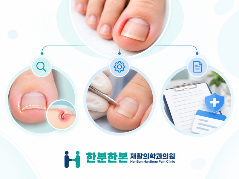 내성발톱 실비 청구 방법, 치료 전 확인해야 할 기준