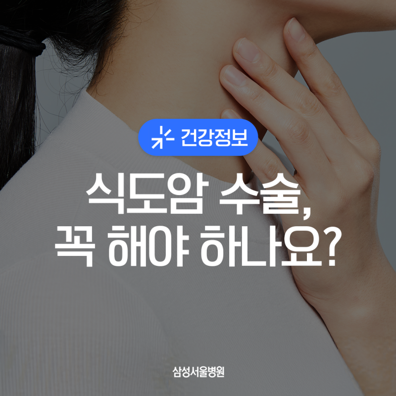 식도암 수술 완전 정리, 수술 기준·방법부터 식사·생활관리까지 | 삼성서울병원 폐식도외과....