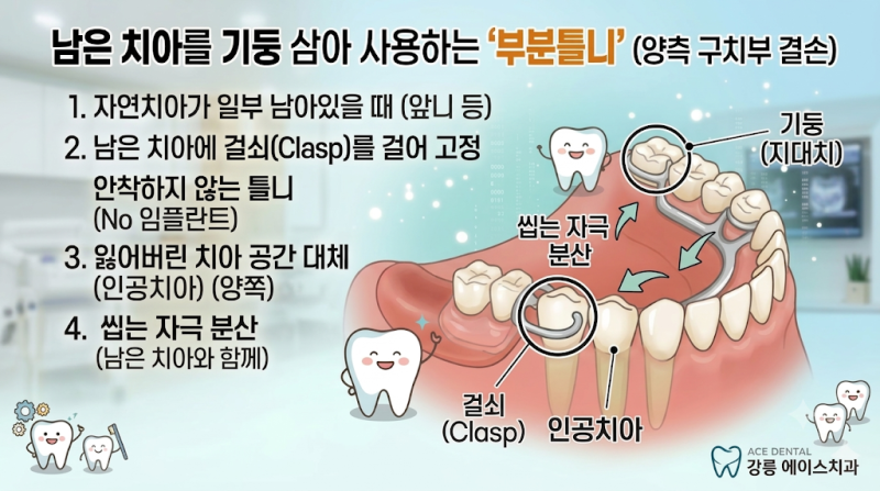 씹는 즐거움을 되찾는 방법: 부분틀니, 완전틀니, 임플란트 틀니 총정리
