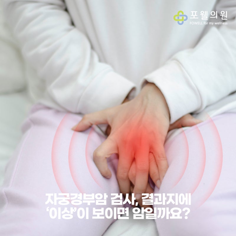 자궁경부암 검사, 결과지에 ‘이상’이 보이면 암일까요?