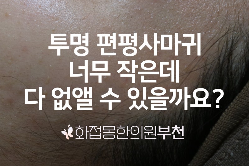 얼굴 편평사마귀 투명하고 너무 작은데 다 없앨 수 있을까요? 1인실 여원장 진료 화접몽한의....