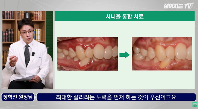 방배역치과 임플란트식립과정, 시니올 시스템이 중요한 이유