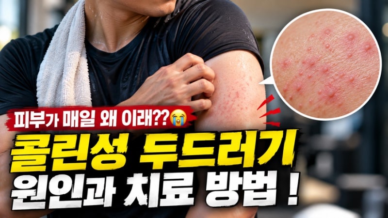 피부가 매일 왜 이래?? 콜린성 두드러기, 원인과 치료 방법!