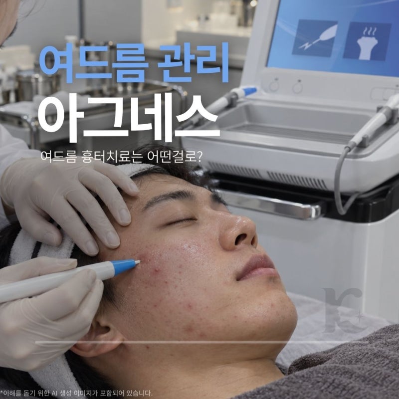 광주 여드름 관리는 아그네스 시술 후 흉터 치료도 필요할까?