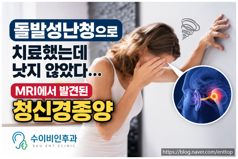 [순천 수이비인후과] 갑자기 한쪽 귀가 안 들렸다 돌발성난청으로 치료했지만, MRI에서 ‘청....
