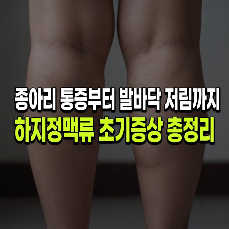 하지정맥류 초기증상, 종아리 통증부터 발바닥 저림까지? 우리가 몰랐던 숨겨진 신호