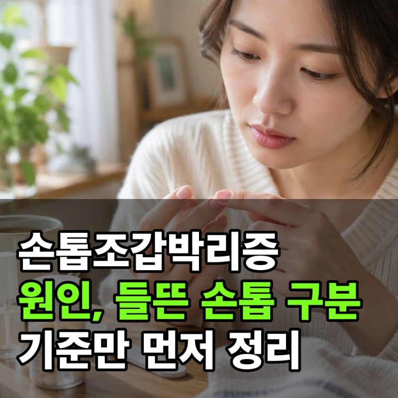 손톱조갑박리증 원인, 들뜬 손톱 구분 기준만 먼저 정리