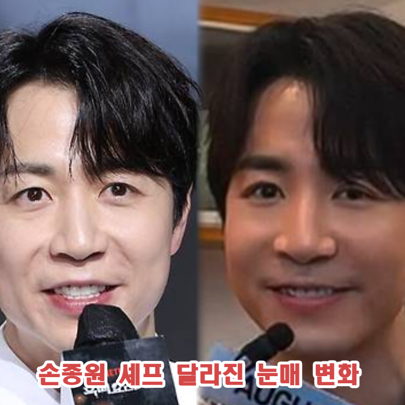 손종원 눈매 변화 짙은 쌍꺼풀 왜? 성형? 눈 밑 지방재배치 가능성은?