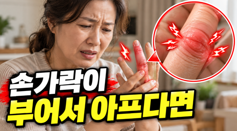류마티스 관절염이 걱정될 때, 증상부터 검사와 치료까지
