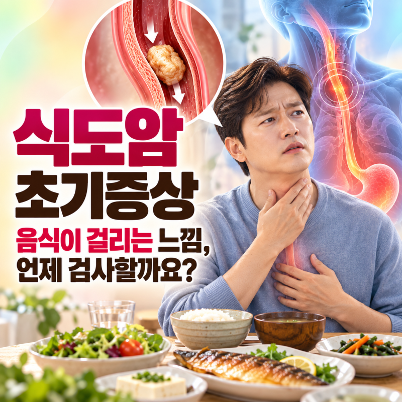 식도암 초기증상 5가지, 음식이 걸리는 느낌은 언제 내시경 검사를 해야 할까요?