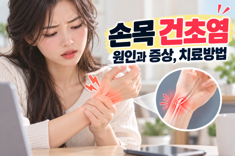 엄지손가락부터 손목까지 아프다면? 손목 건초염 증상과 원인·치료방법