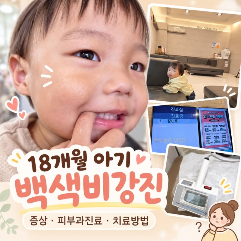 18개월 아기 피부 흰점, 백색 비강진 증상 및 피부과 진료 후기 그리고 치료방법