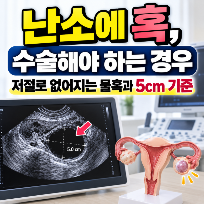 난소에 혹 수술해야 하는 경우, 저절로 없어지는 물혹과 5cm 기준