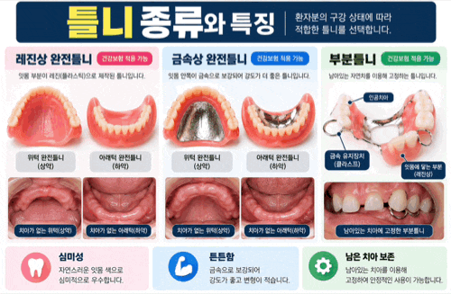 대구 틀니 가격, 65세 이상이면 비용이 얼마나 들까요?