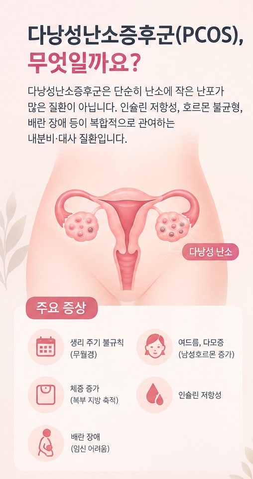 다낭성난소증후군과 이노시톨, 꼭 먹어야할까요? 인슐린과 호르몬의 관계