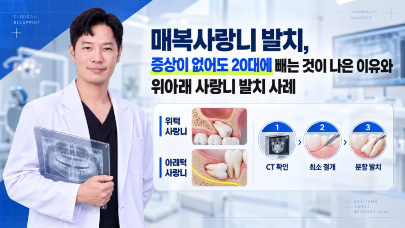 공덕 치과, 매복사랑니 발치, 아프지 않아도 20대에 발치하는 것이 나은 이유