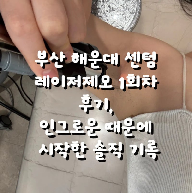 부산 해운대 피부과 레이저제모 1차 후기, 인그로운 제거 효과