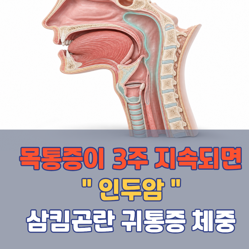 이 목 통증이 3주 넘게 계속되면 암일 수도 있습니다! 인두암 초기증상 | 한쪽 목 통증 3주 후....