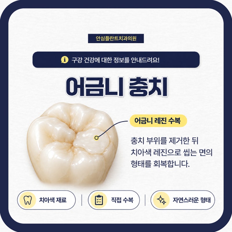 대구 어금니 충치치료 종류 어떤게 있나요?