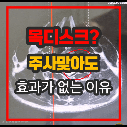 동탄 목디스크 병원 치료 후에도 통증이 계속되는 진짜 이유