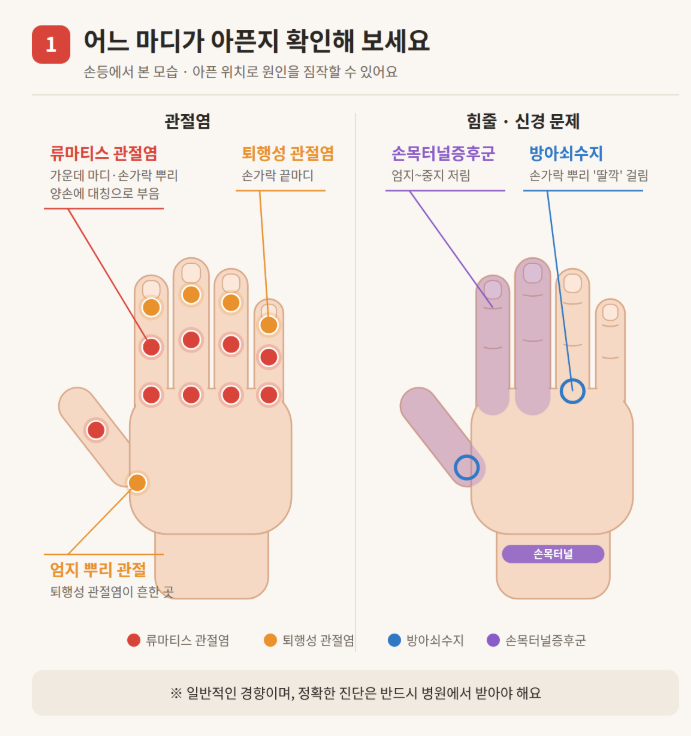 아침마다 손가락이 뻣뻣하고 아프다면 ?꼭 확인해야 할 질환 총정리