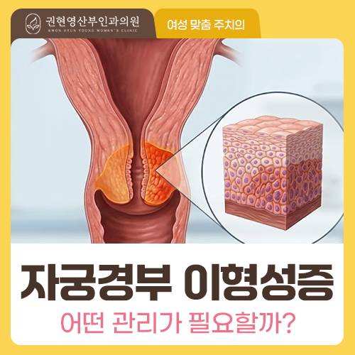부산 녹산 산부인과 자궁경부이형성증? 2가지만 기억하세요