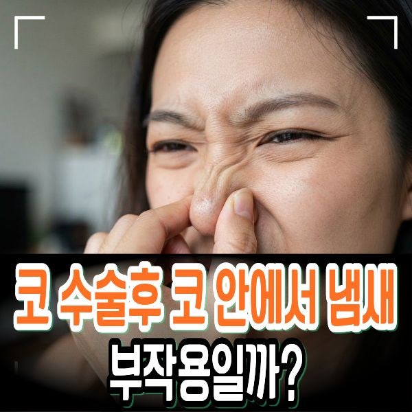 코 수술후 코 안에서 냄새 부작용일까? 정상 vs 염증 구분법