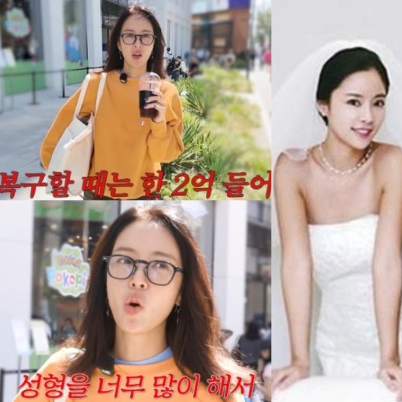 황정음 유튜브 성형고백 "성형 복구하느라 2억든다" 리즈시절은?