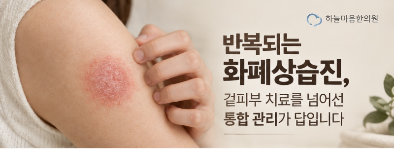 [화폐상 습진] 반복되는 화폐상습진, 겉피부 치료를 넘어선 통합 관리가 답입니다-하늘마음....