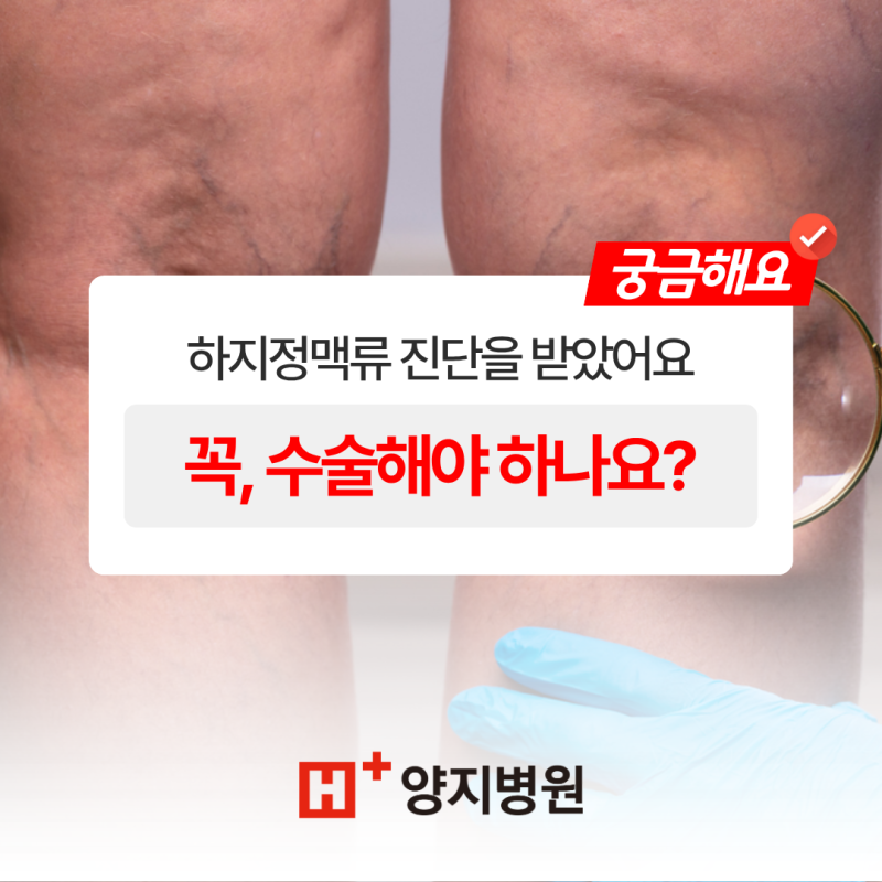 하지정맥류, 꼭 수술이 필요할까요? 회복기간은요?