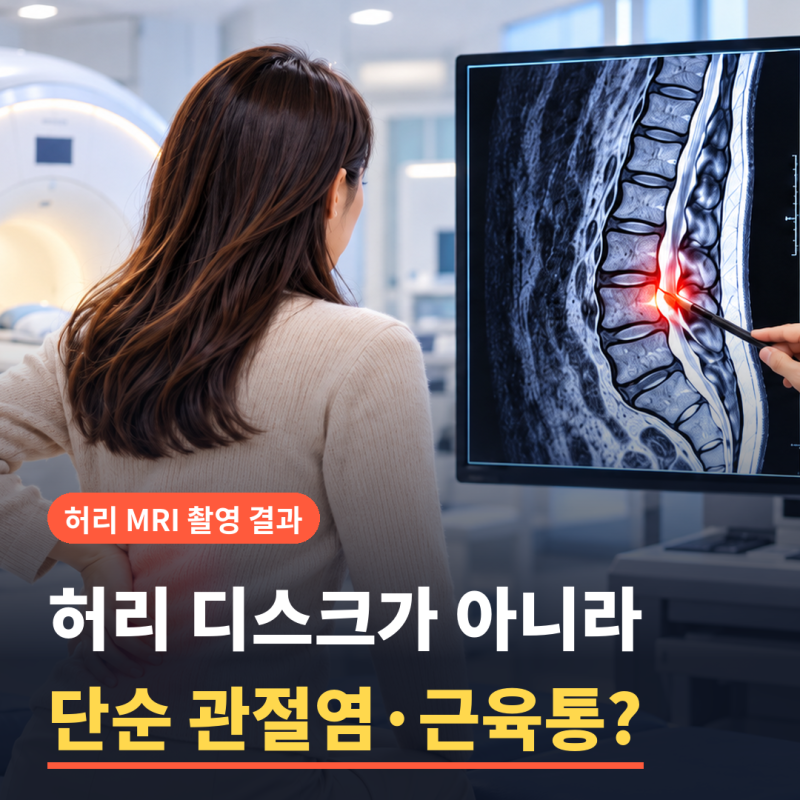 내가 허리 디스크가 아니라 단순 관절염, 근육통이었다고? 허리 MRI 촬영 결과