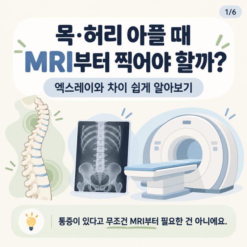 목·허리 아플 때 MRI부터 찍어야 할까? 엑스레이와 차이 쉽게 알아보기