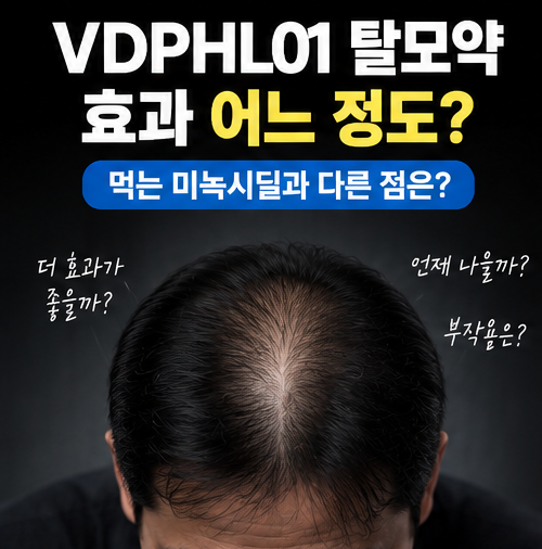 VDPHL01 탈모신약 효과 어느 정도? 먹는 미녹시딜과 다른 점