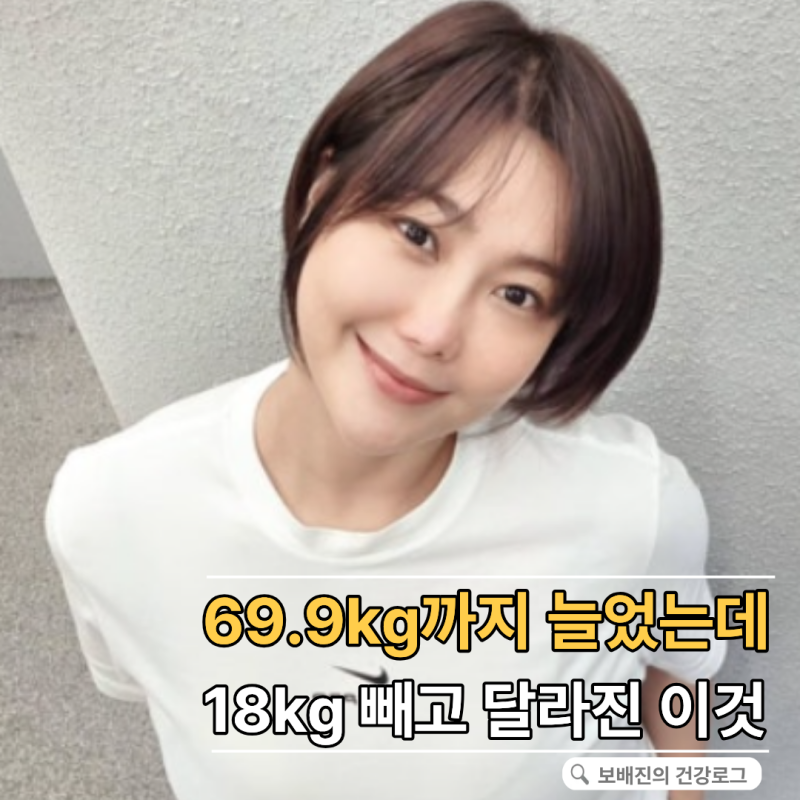 69.9kg까지 늘었던 솔비, 18kg 빼고도 놀란 건 몸무게보다 "이 변화"