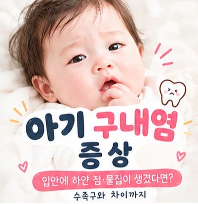 육아정보)아기 구내염 증상｜입안에 하얀 점·물집이 생겼다면? 수족구와 차이까지